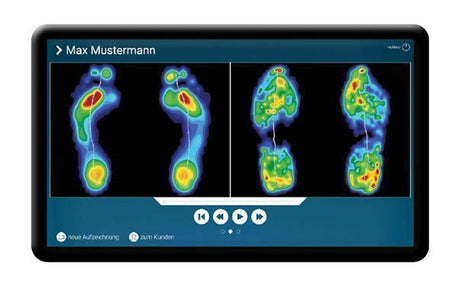 Bild von Molibso-Laufbandanalyse